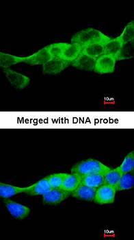 IKK beta antibody