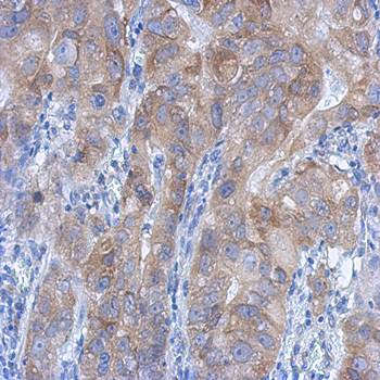 IKK beta antibody