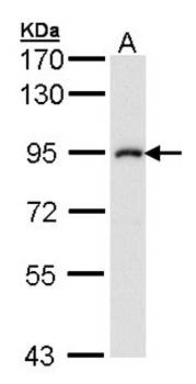 IKK beta antibody