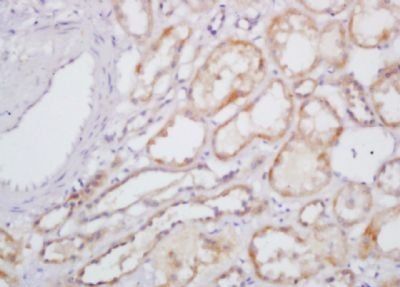 IL-31 Rabbit Polyclonal Antibody