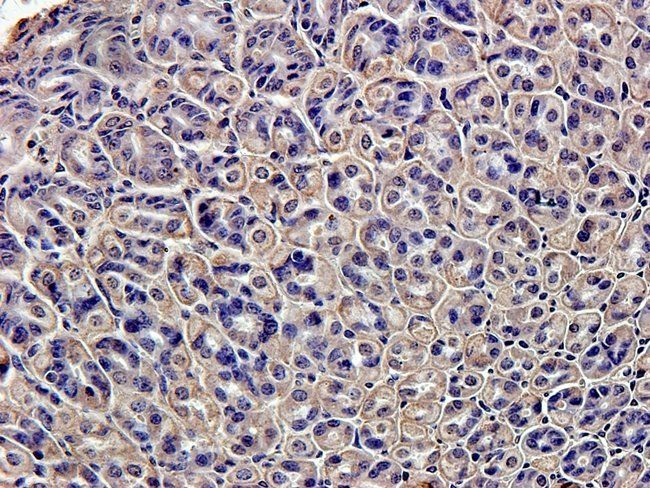 IL1 beta Rabbit Polyclonal Antibody
