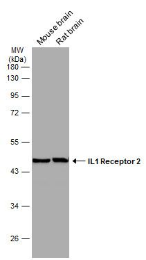 IL1 Receptor 2 Rabbit Polyclonal Antibody