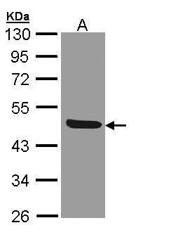 IL1 Receptor 2 Rabbit Polyclonal Antibody