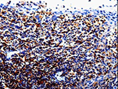 IL10RA Antibody