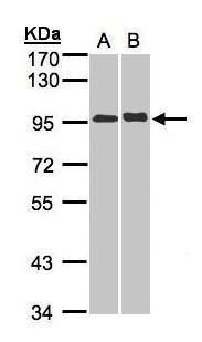 IL12 Receptor beta2 Rabbit Polyclonal Antibody