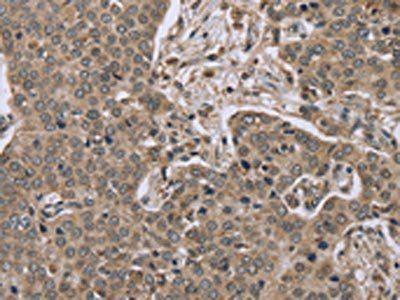 IL15RA Antibody