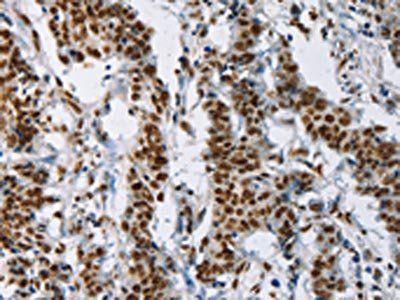 IL17C Antibody