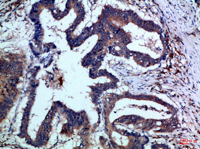 IL17F Antibody