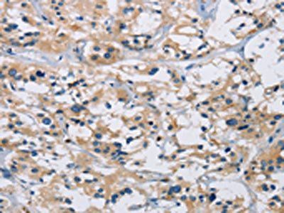 IL17RB Antibody