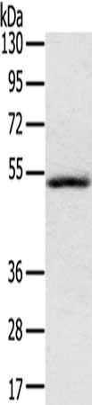 IL17RB Antibody