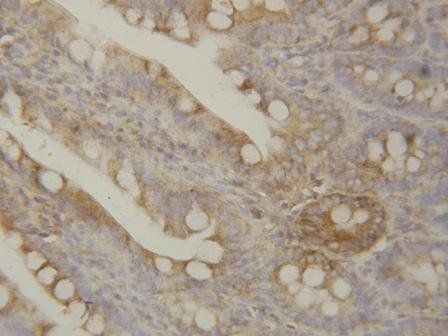 IL1 beta/IL1B Rabbit Polyclonal Antibody