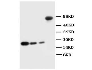 IL1 beta/IL1B Rabbit Polyclonal Antibody
