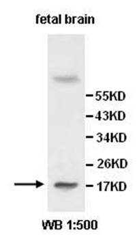 IL1A Rabbit Polyclonal Antibody