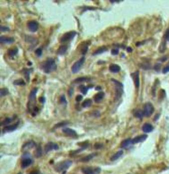 IL1A Rabbit Polyclonal Antibody