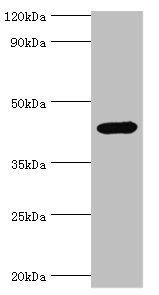 IL1R2 Antibody