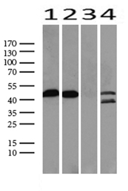 IL20RA Antibody