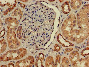 IL22RA2 Antibody