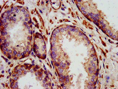 IL24 Antibody