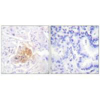 IL2RB (Ab-364) Antibody