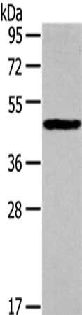 IL3RA Antibody