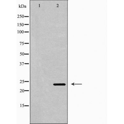 IL6 Antibody
