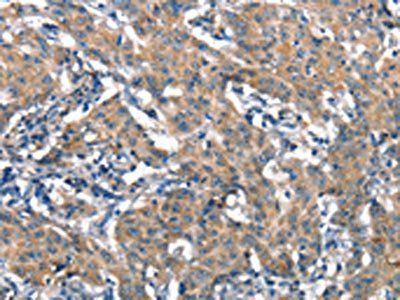 HGF Antibody