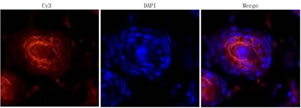IL6 antibody