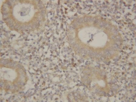 IL8/CXCL8 Rabbit Polyclonal Antibody