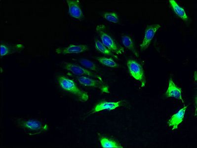ILVBL Antibody