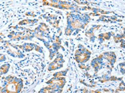 IMMT Antibody