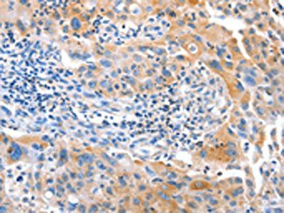 IMMT Antibody