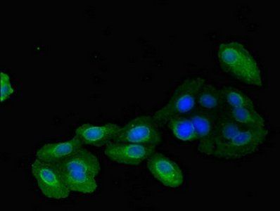 IMMT Antibody