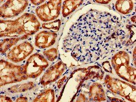 IMMT Antibody