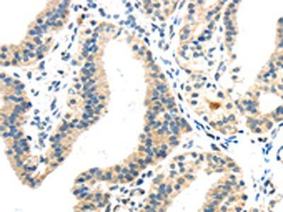 INHBB Antibody