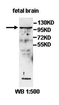 INPP4A Rabbit Polyclonal Antibody