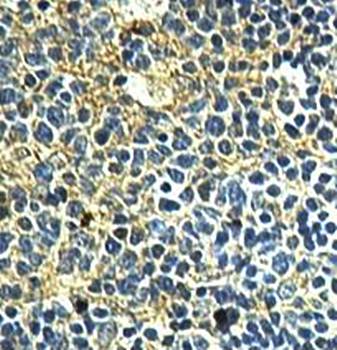 INPP4A Rabbit Polyclonal Antibody