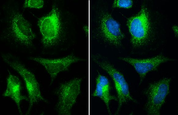 INPP5F Rabbit Polyclonal Antibody