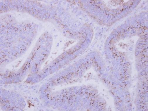 INPP5F Rabbit Polyclonal Antibody