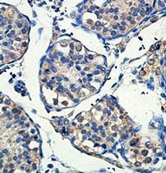 INSL6 Rabbit Polyclonal Antibody