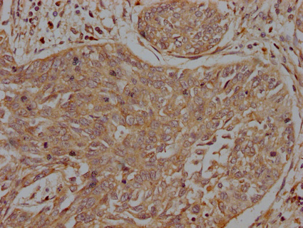 INSRR Antibody