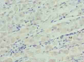 IGFBP1 Antibody