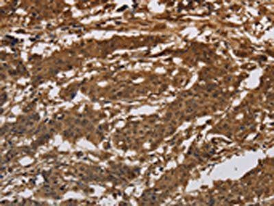 ITGB7 Antibody