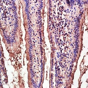Integrin alpha 4+Beta 7 Rabbit Polyclonal Antibody