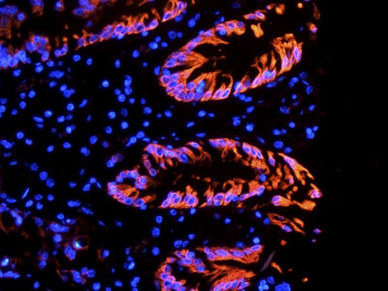 Integrin alpha 5 antibody