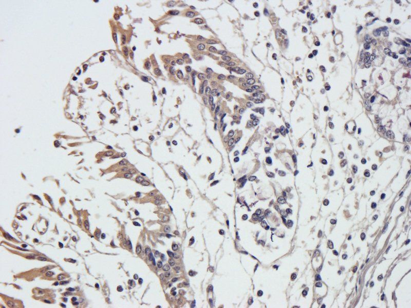 Integrin alpha 5 antibody