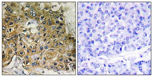 Integrin β1 (Phospho-Thr789) Antibody