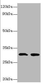 IL1B Antibody