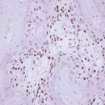 IP6K1 antibody