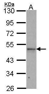 IPMK Rabbit Polyclonal Antibody