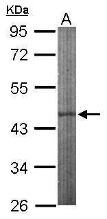 IPMK Rabbit Polyclonal Antibody